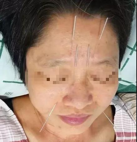 ���ӡ��Ѩ�Q�销��Ѩ