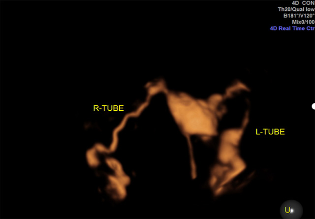 �p��(c��)ݔ�ѹ�ͨ������