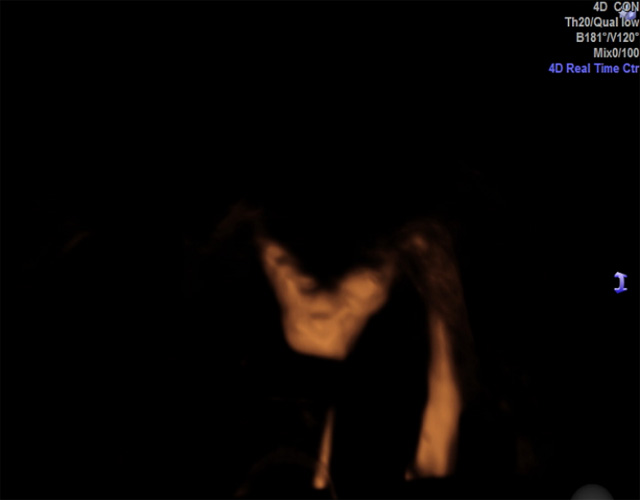 ���(c��)ݔ�ѹ�ͨ�����҂�(c��)ݔ�ѹܶ���